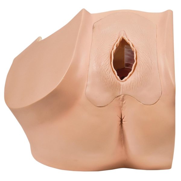 Gynecological Model for Patient Education - Image 3