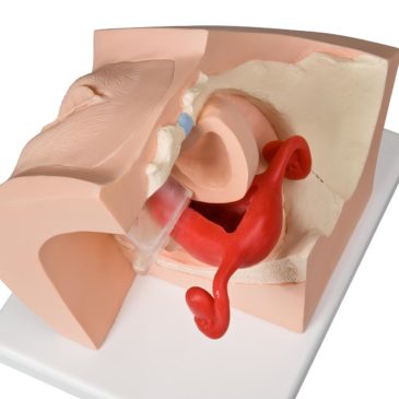Gynecological Model for Patient Education