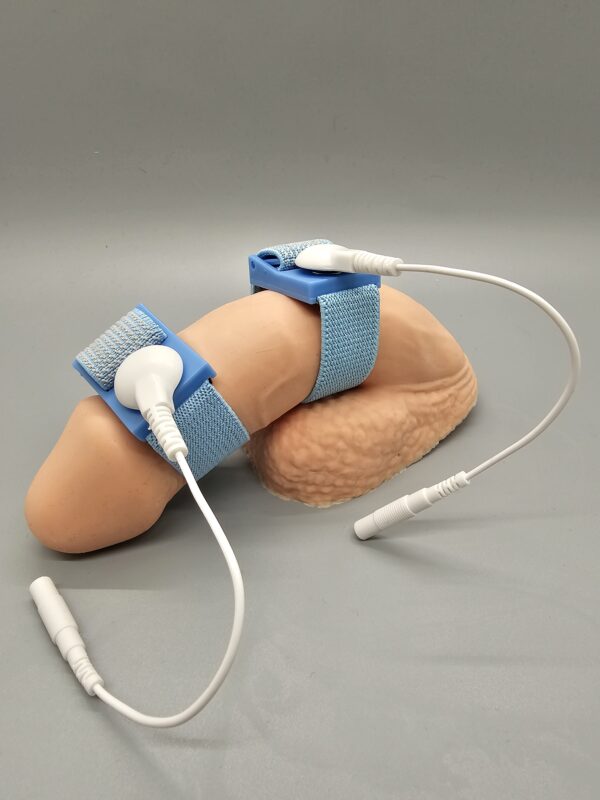 Circumferential Penile Electrodes for Chronic Pelvic Pain