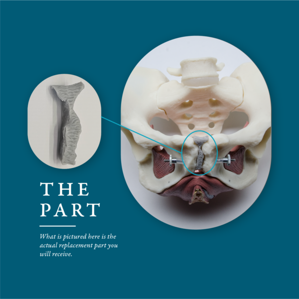 Pubis Symphysis Replacement Part for the ESP Female Model