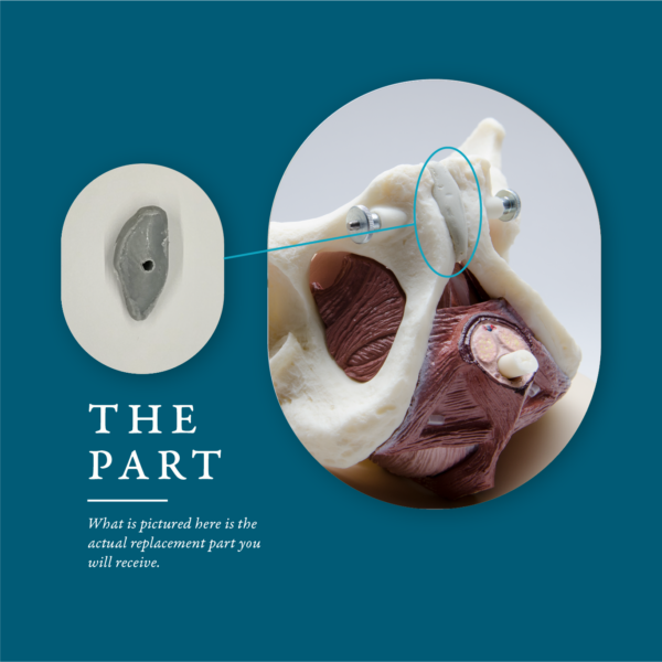 Pubis Symphysis Replacement Part for ESP Male Model