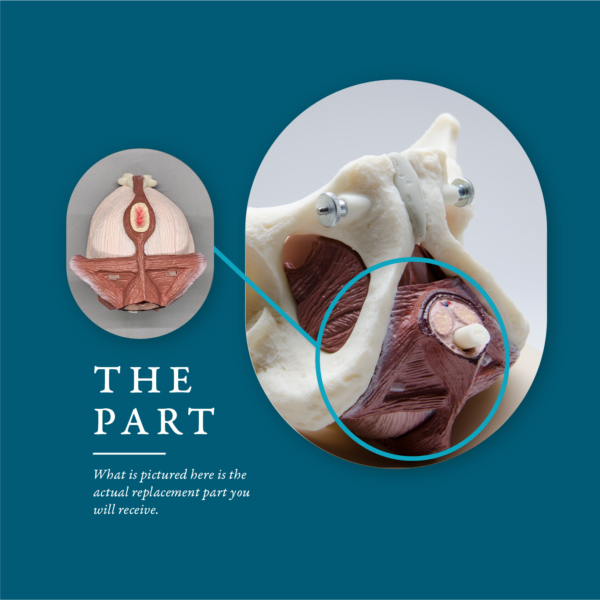Pelvic Floor Replacement for ESP Male Model