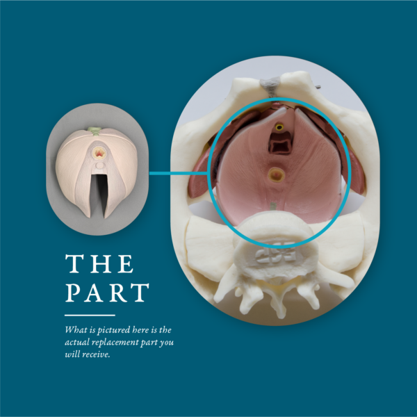 Pelvic Floor Replacement Part for ESP Female Model